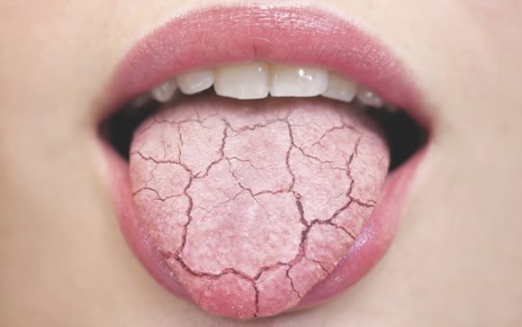 What Causes Dry Mouth at Night